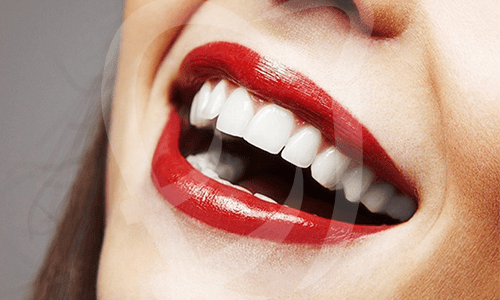 Estetik diş və estetik gülüşün dizaynı
